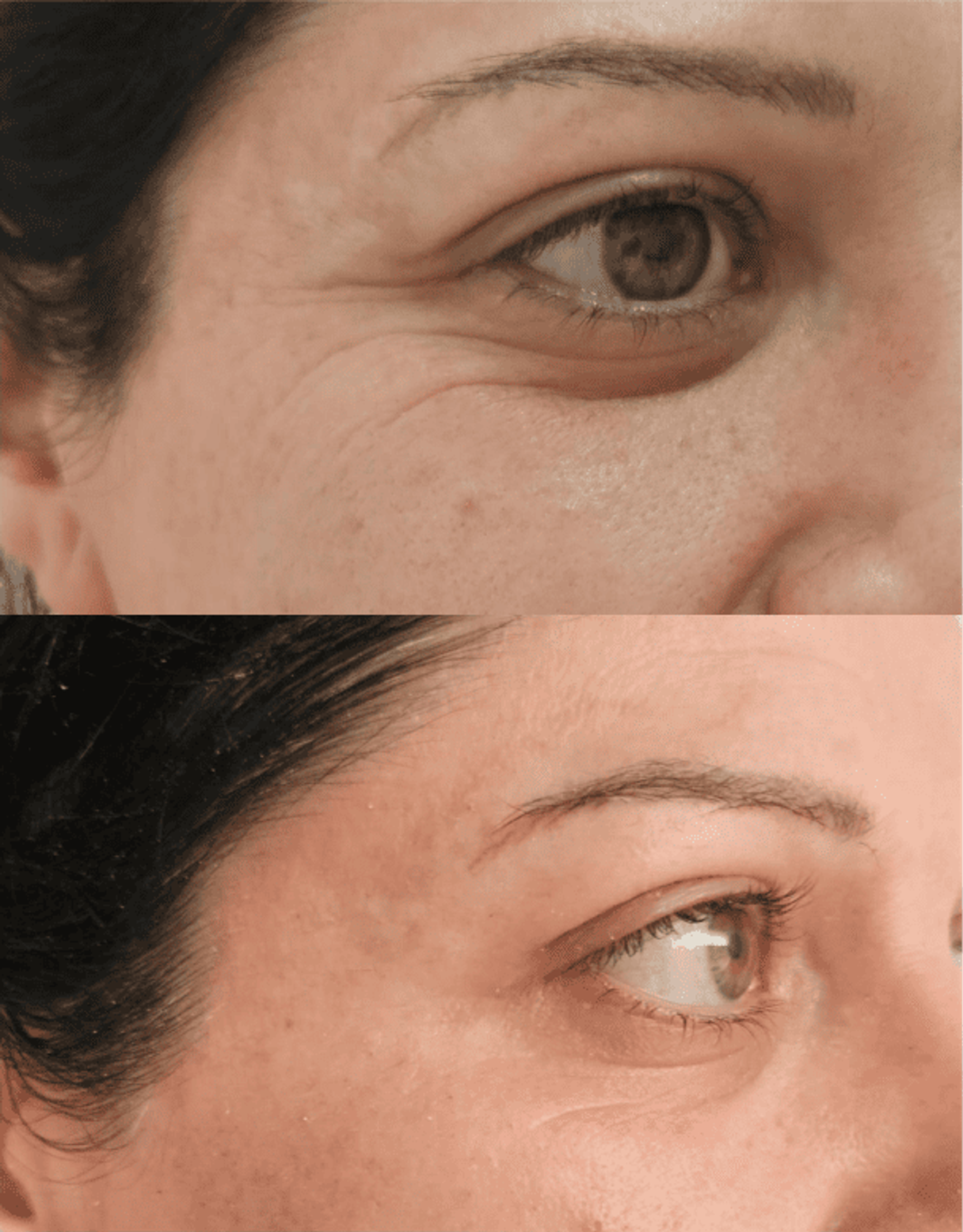 Antes y después de tratamientos faciales 1