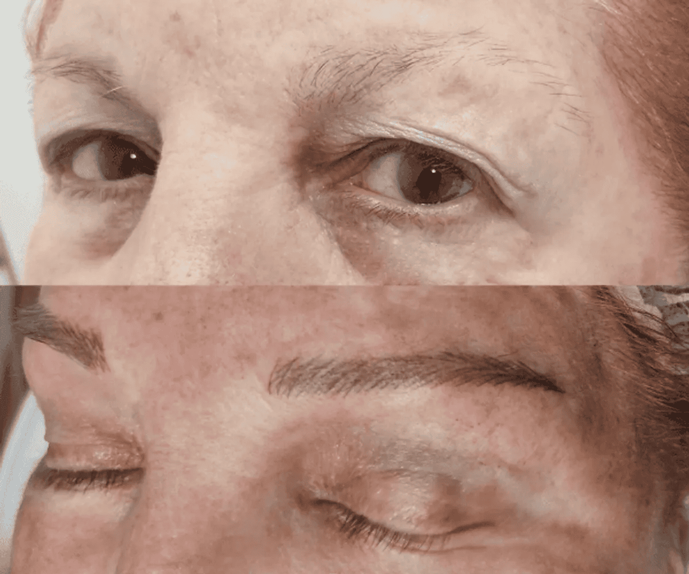 Antes de la tratamientos de cejas 13