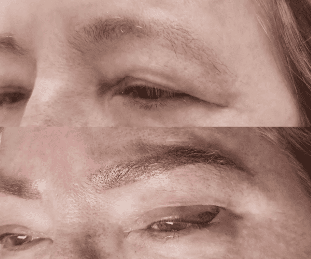 Antes de la tratamientos de cejas 12