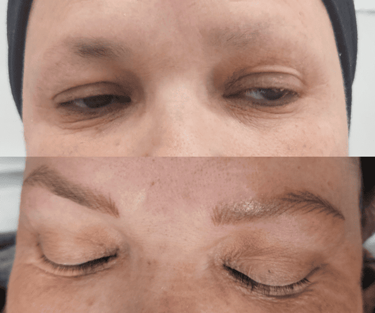 Antes de la tratamientos de cejas 11