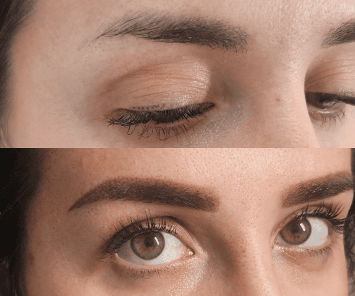 Antes de la tratamientos de cejas 10