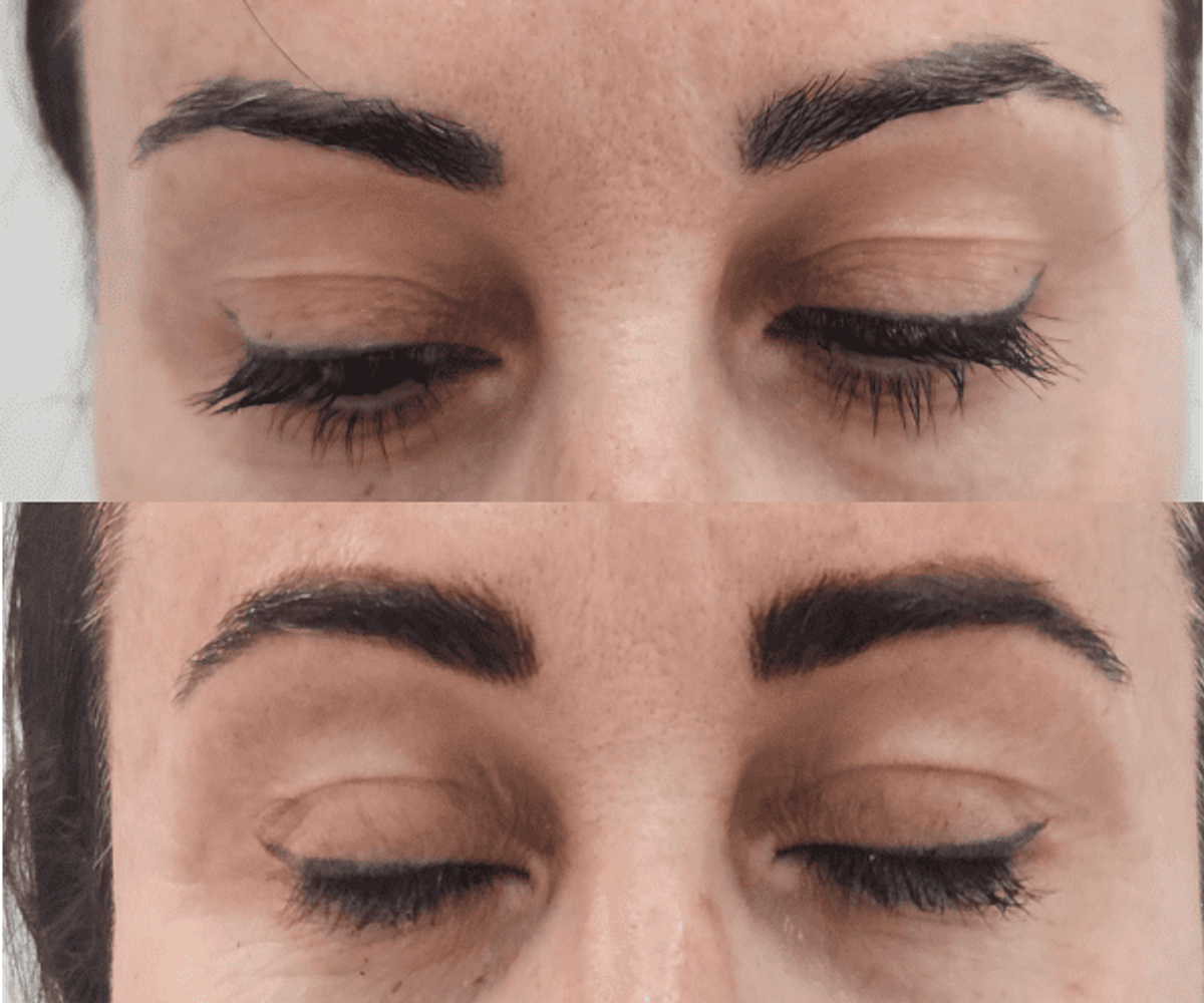Antes de la tratamientos de cejas 14