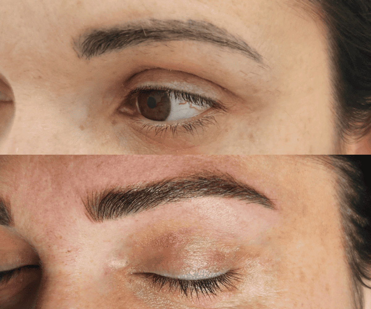 Antes de la tratamientos de cejas 15