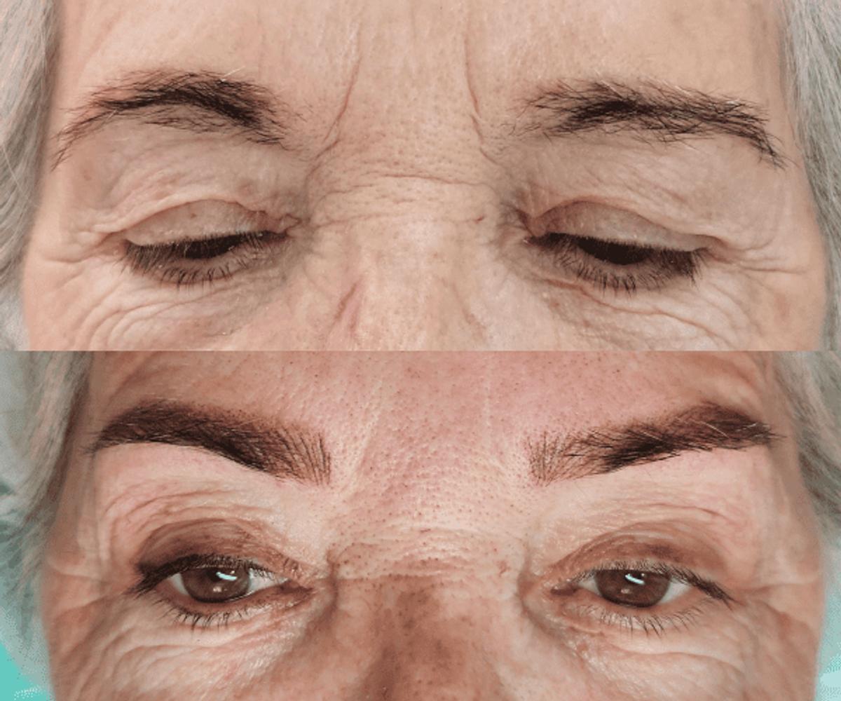 Antes de la tratamientos de cejas 16