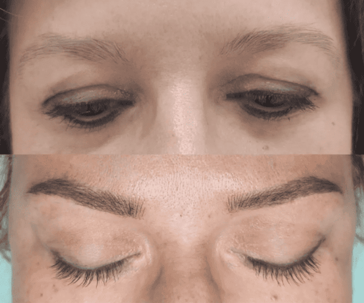 Antes de la tratamientos de cejas 2