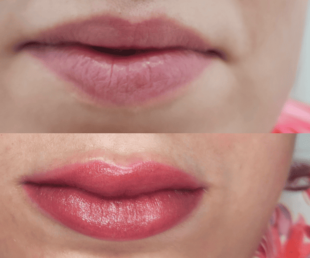 Antes y después de micropigmentación de labios - Caso 3