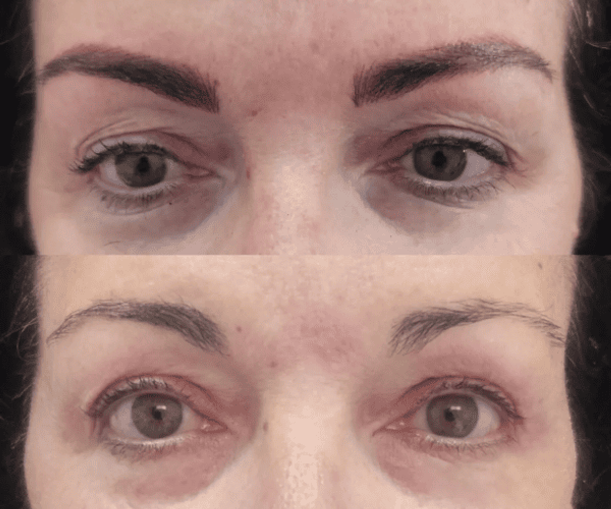 Antes de la tratamientos de cejas 6