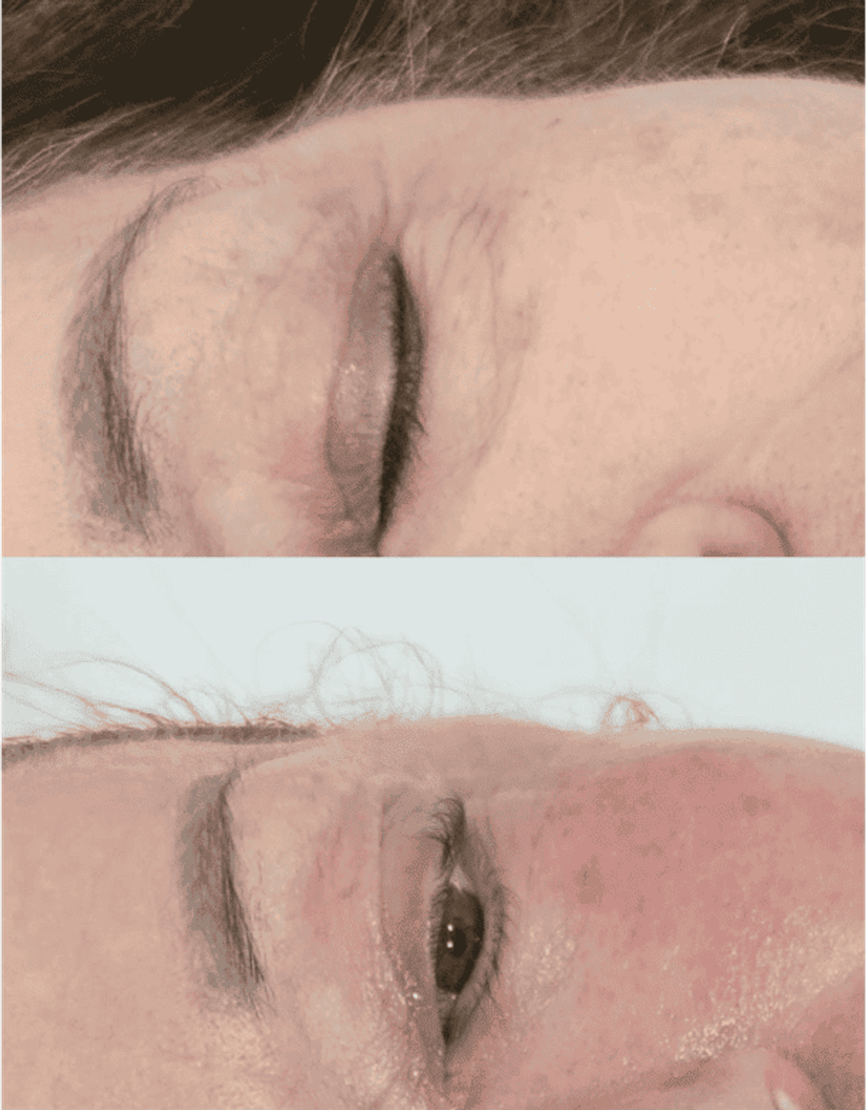 Antes y después de tratamientos faciales 7
