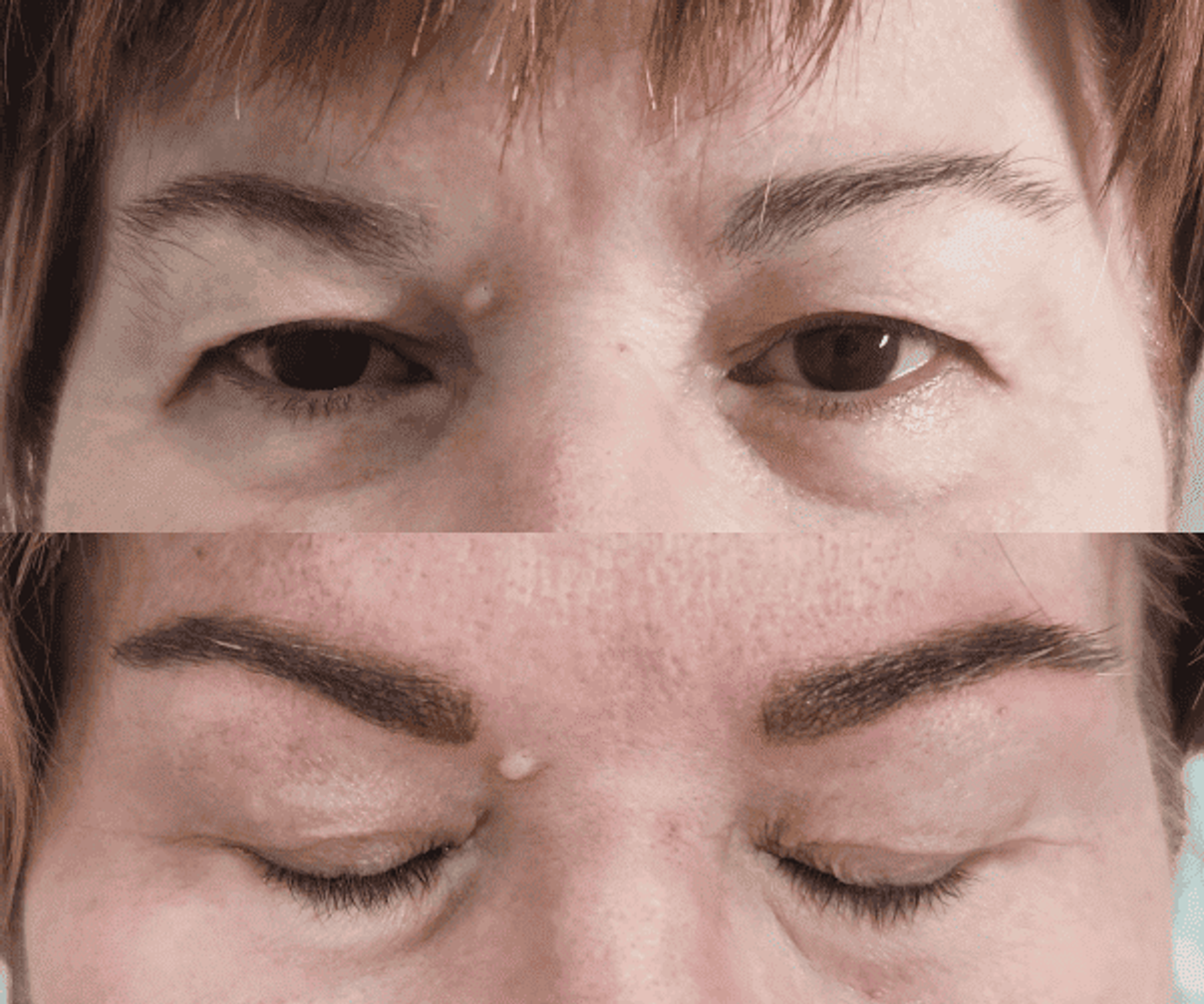 Antes de la tratamientos de cejas 7