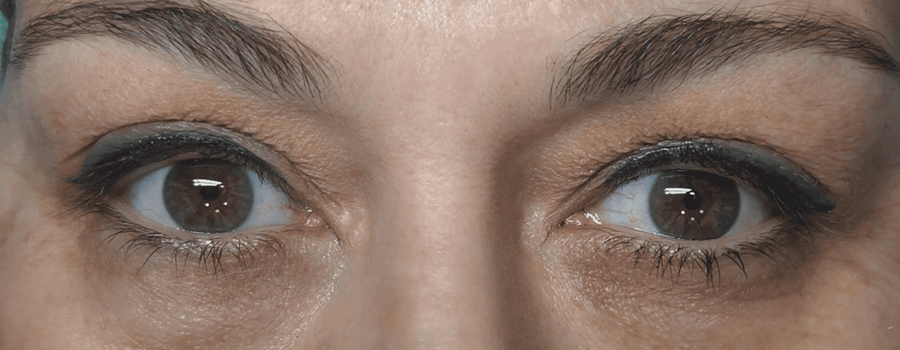 Médico explicando tratamiento ocular