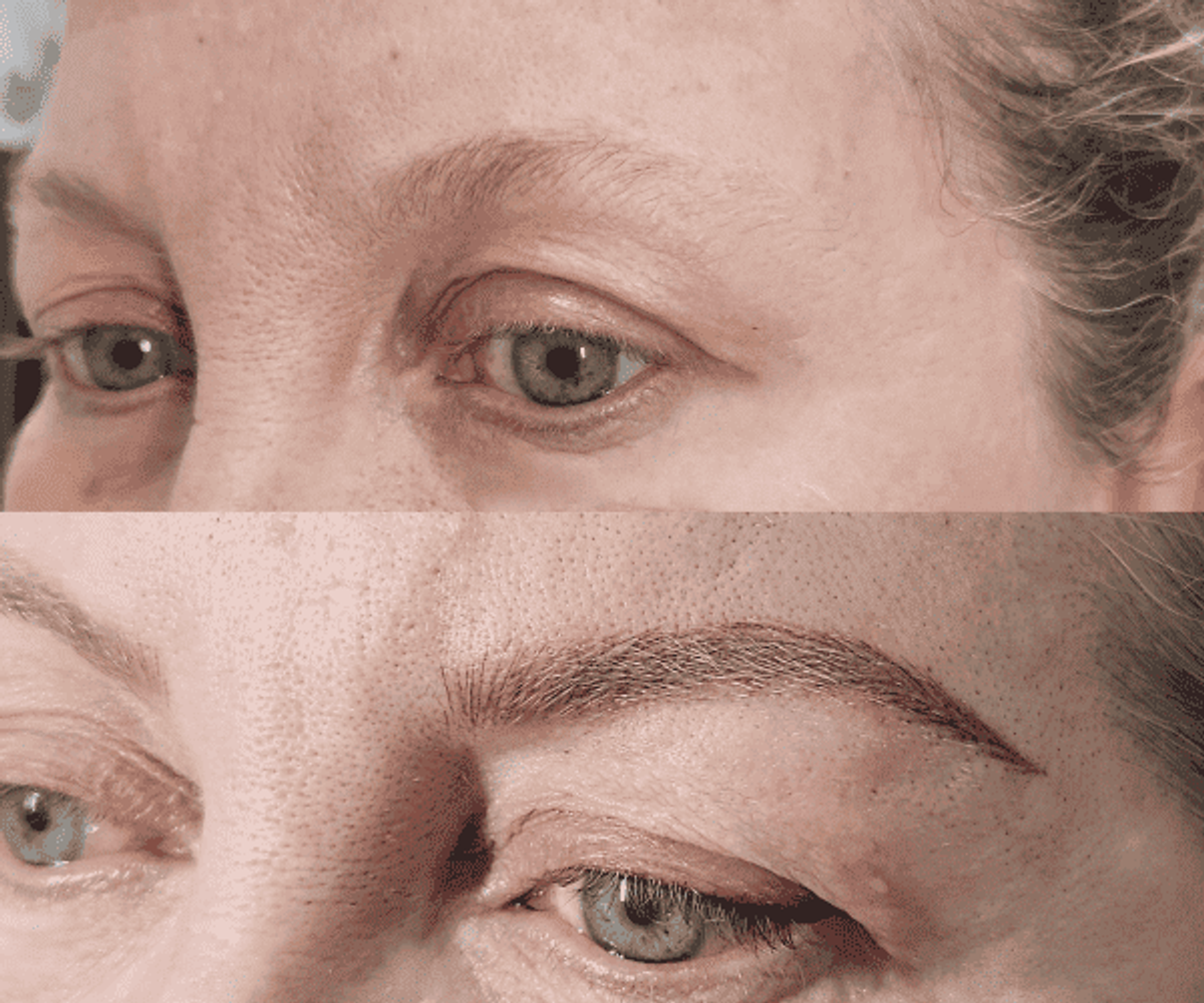 Antes de la tratamientos de cejas 8