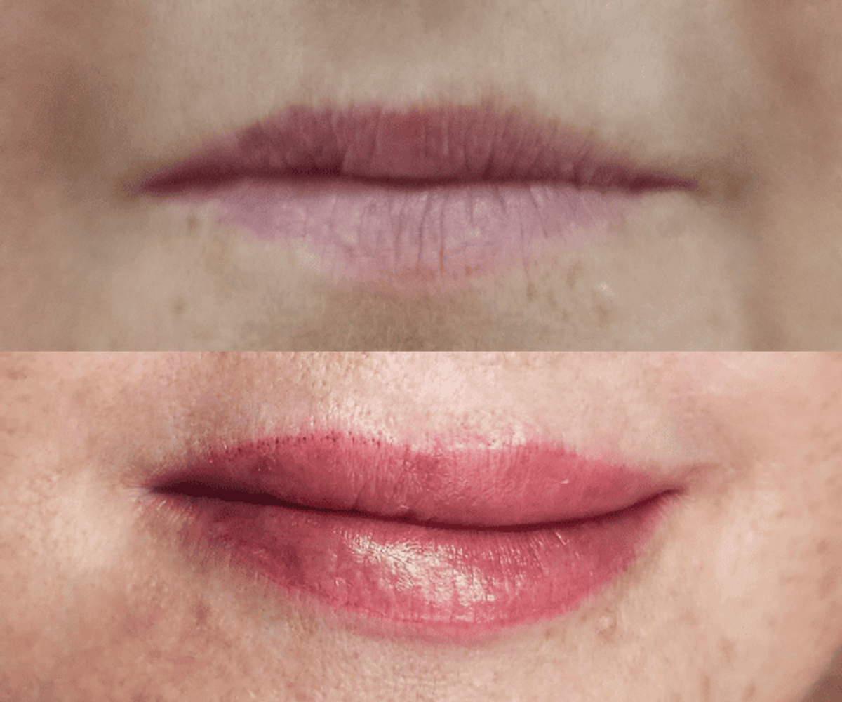 Antes y después de micropigmentación de labios - Caso 8