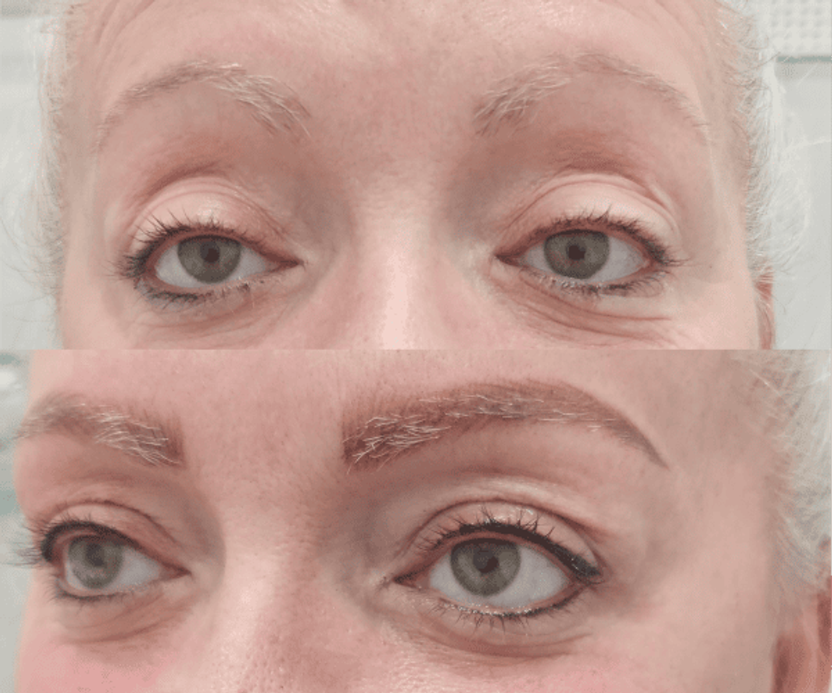 Antes de la tratamientos de cejas 9