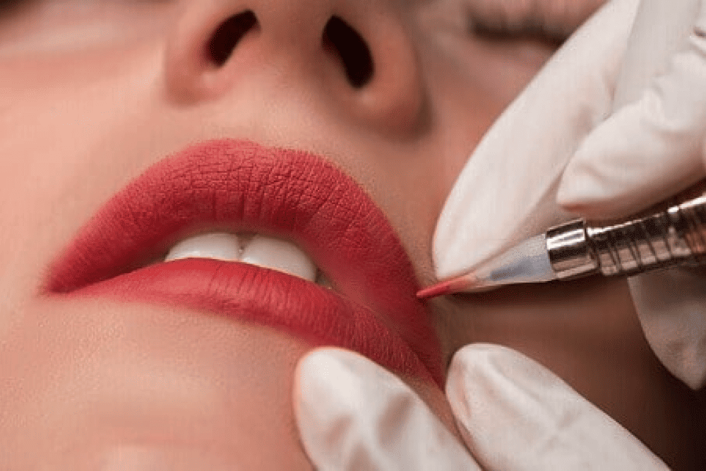 Tratamiento de diseño de labios